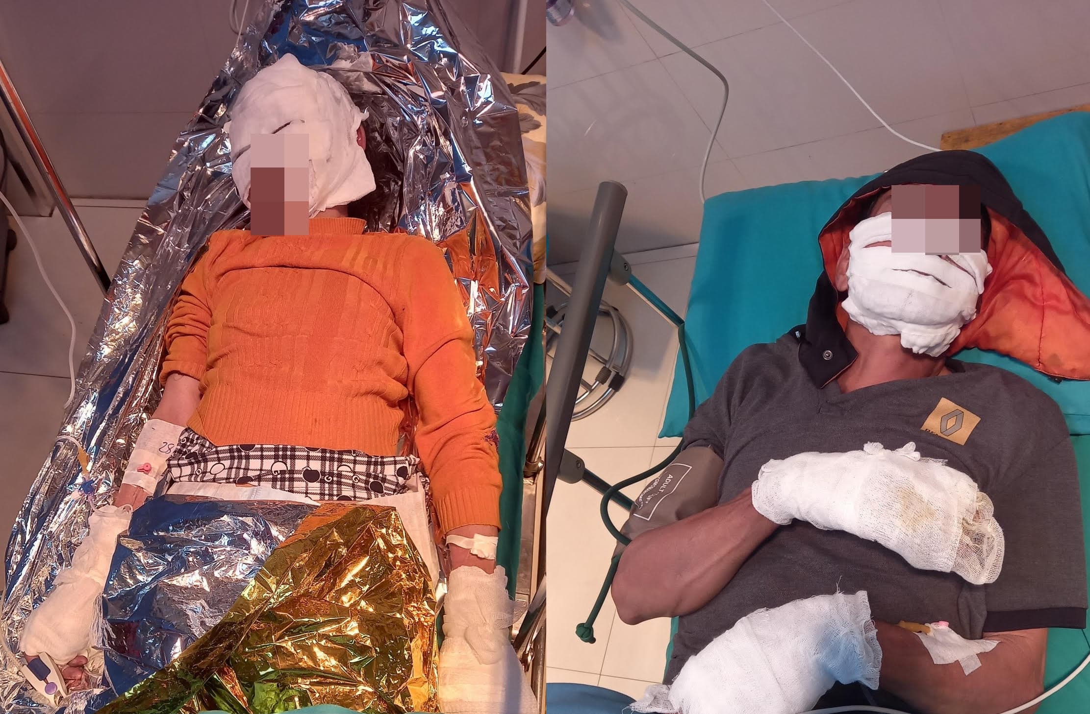 這對夫妻因手機爆炸嚴重燒傷,被緊急送醫急救。(翻攝雄王醫院臉書)