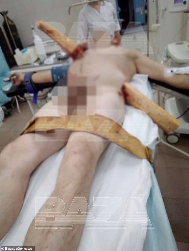尼可拉身體被大塊木板貫穿。(翻自《每日郵報》)