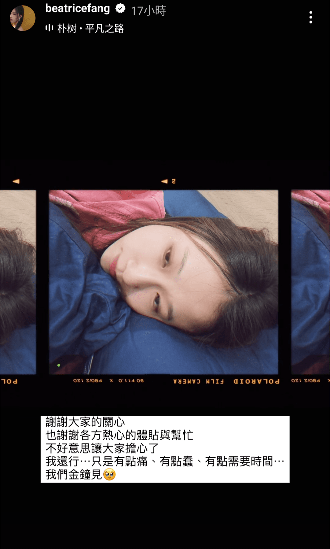 昨天傳出方志友定裝時重摔受傷，她晚間曬出近況多謝外界關心。（方志友IG）