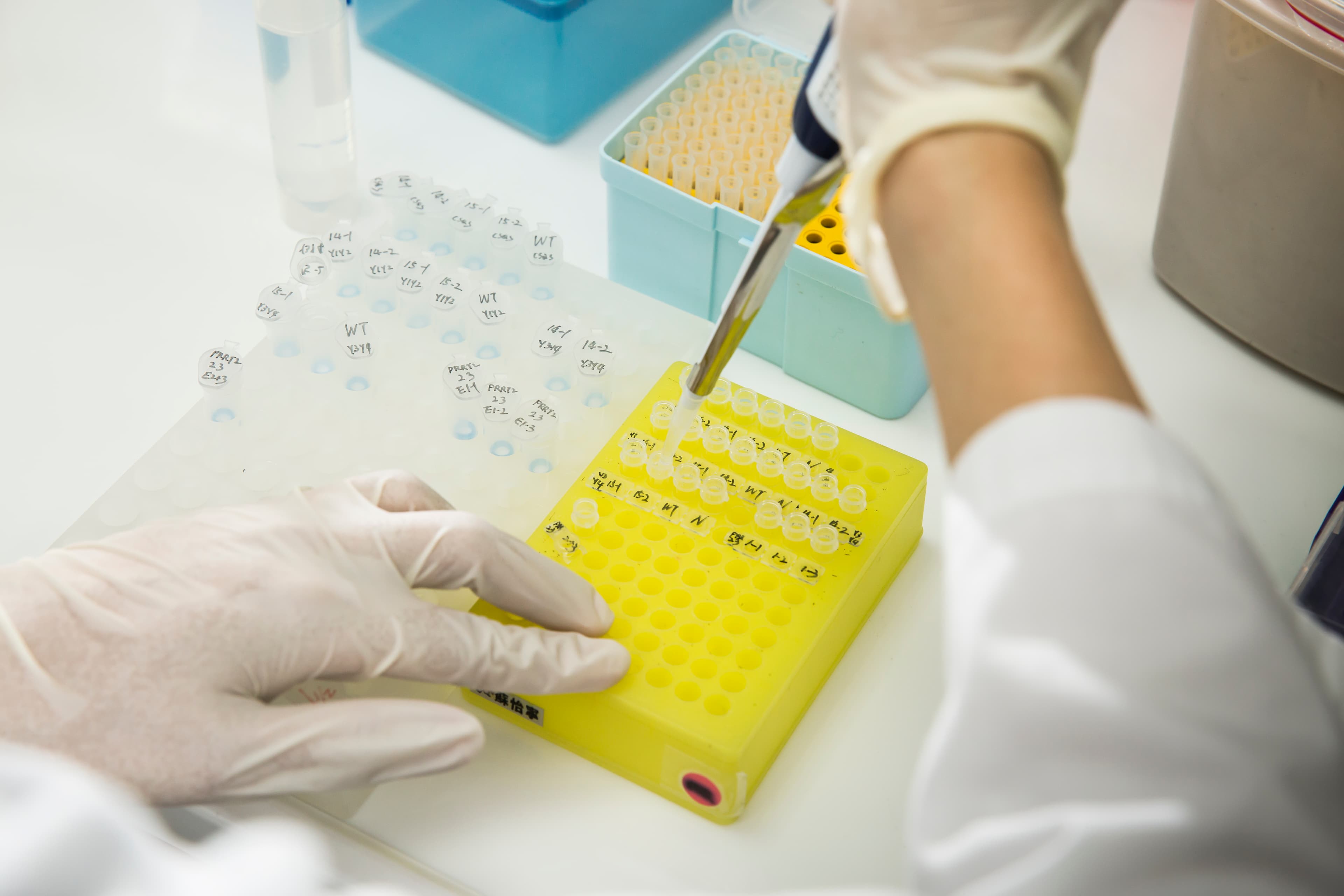 慧智基因能診斷超過1000種基因異常,分裝後的DNA,依據客戶指定的基因檢測,在DNA內加入不同試劑,以進行後續檢測。