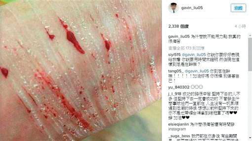 劉錚曾在IG貼出一張疑似自殘的照片,讓粉絲相當擔心。(翻攝自劉錚IG)