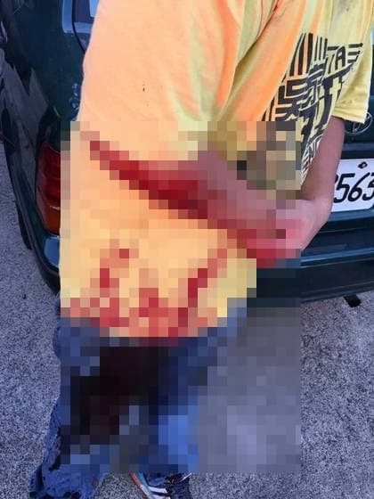 朱女大兒子護母搶槍,右臂被射傷,只能眼睜睜的看著「叔叔」殺死母親。