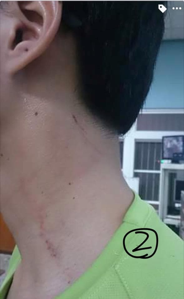 員警被打還被高層想要息事寧人,怒po網將事件經過公諸於世,直言受到委屈想跳八掌溪。(警方提供)