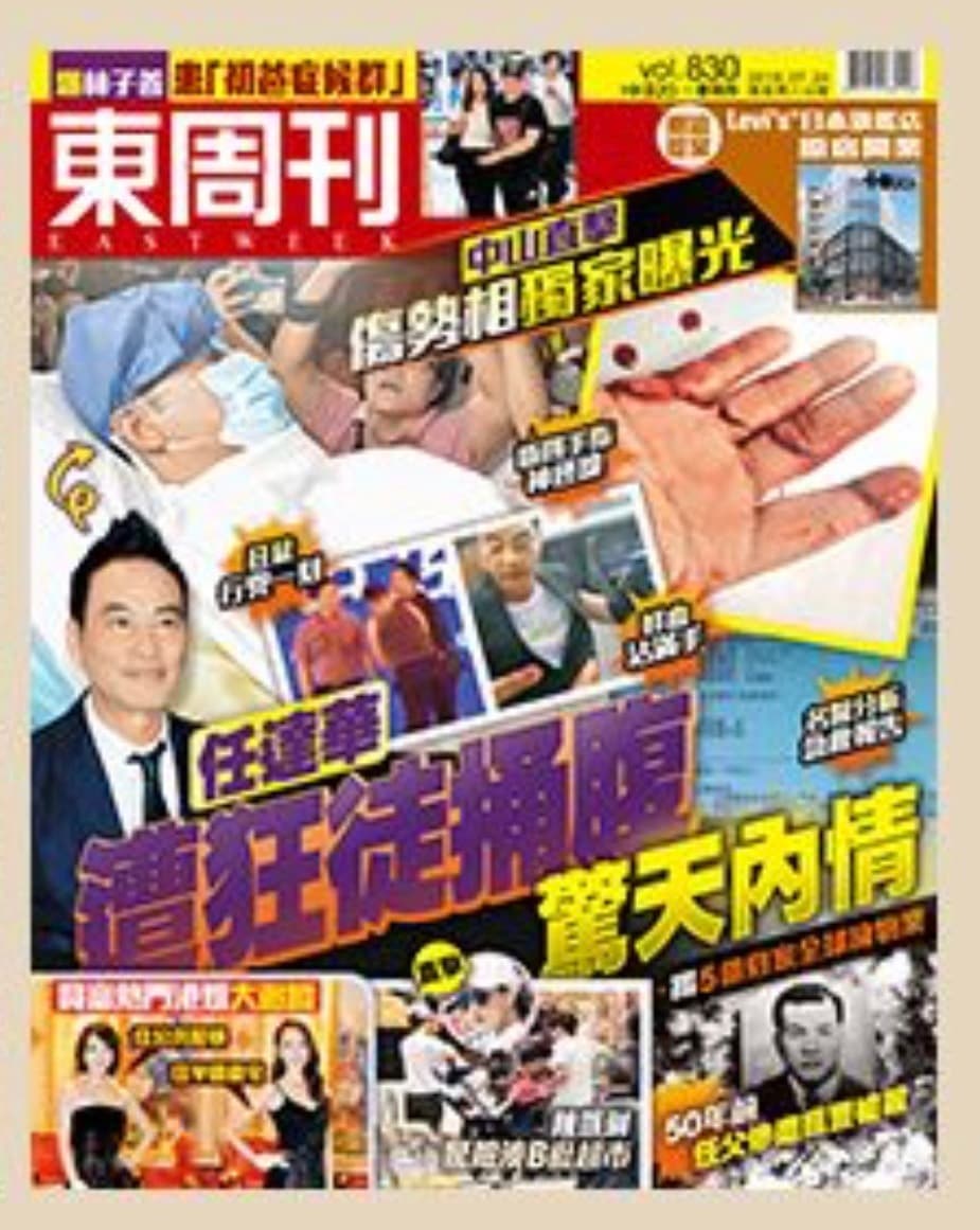 港媒曝光任達華右手傷勢照片,4指神經線遭割斷,血跡斑斑十分嚇人。(翻攝自東周刊封面)