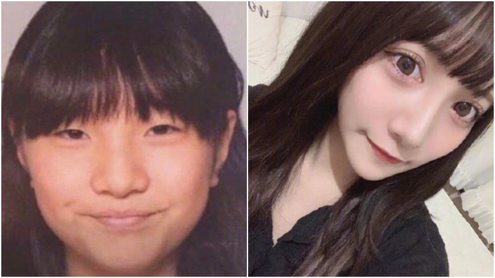 作間龍斗的私生飯不滿被偶像拒絕,整形去勾引偶像及其隊友。圖為整形前後對比。(合成圖,翻攝微博)