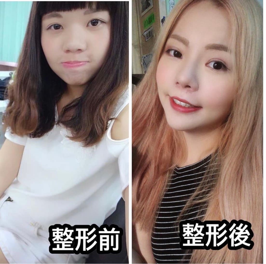 知名網路圖文插畫家超直白,繼年初動刀「修臉」,再次把腦筋動到胸部上。(翻攝自超直白IG)
