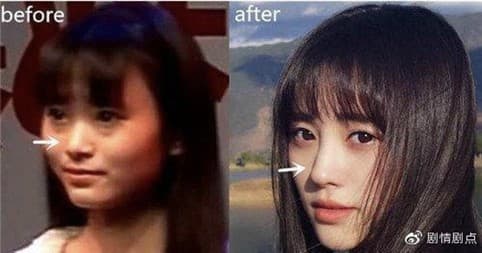 鞠婧禕過去的樣貌十分扁平,與現在十分不同。(翻攝劇情劇點微博)