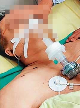 蔡男(圖)送醫後不治,法醫相驗後確認是遭毆打而他殺致死,案件至今發生快1年,吳宗憲遭家屬指控急著落跑當官,案件卻未偵結。(翻攝臉書爆料公社)