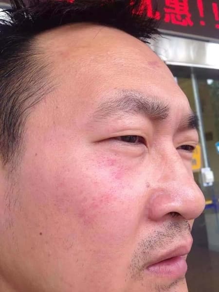 2015年夏天,王全璋在開庭時遭法警從法庭上拖出去、被毆打成傷。事後他立刻向公安報案,還沒對施暴的法警進行訴訟,便遭到抓捕。(翻攝自自網路)
