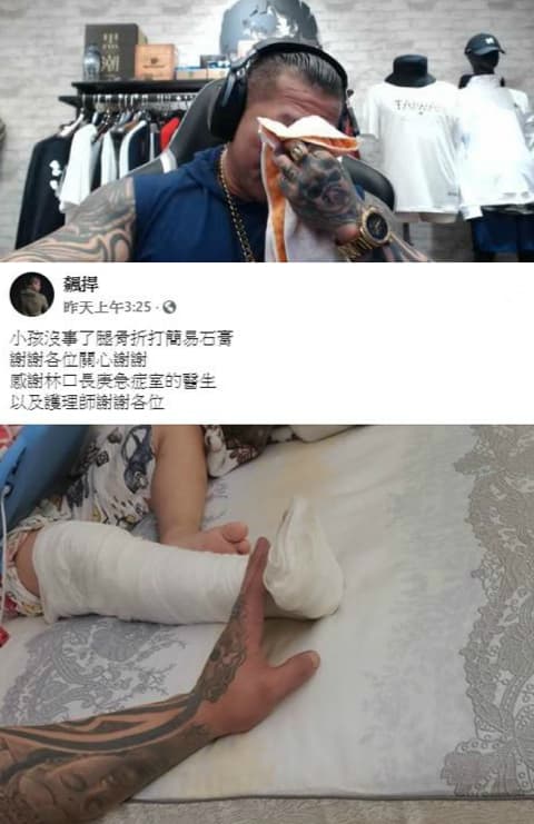 館長直播解釋兒子想玩溜滑梯,小孩不受控,甩開保母的手往前跑,意外被打球的人踩斷腳。(翻攝館長成吉思汗YouTube頻道)
