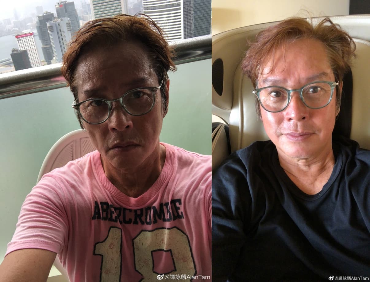 譚詠麟日前臉部消瘦凹陷(左圖),怕粉絲擔心再上傳新照(右圖)。(翻攝自譚詠麟微博)
