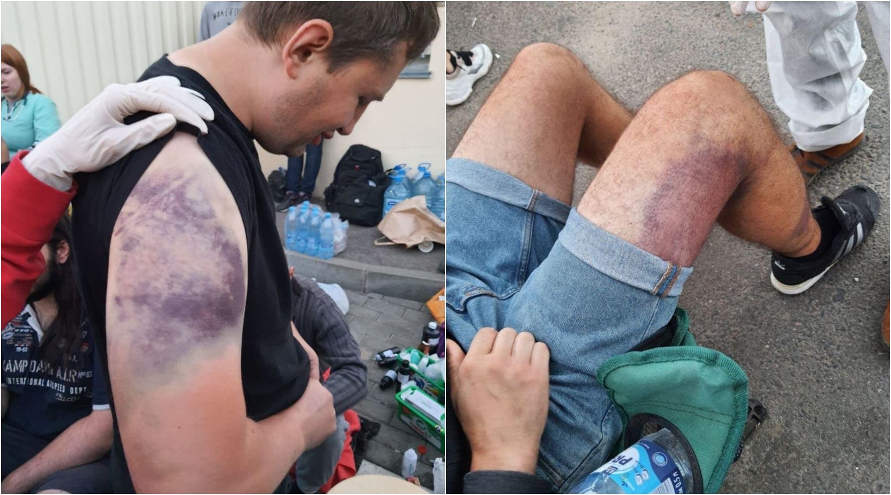 獲釋的民眾指控被警察拘捕毆打虐待,這讓他們對政府不滿情緒更加高漲。(翻攝https://www.svaboda.org/)