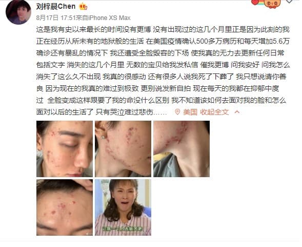 劉梓晨一連po出4張近照，表示自己正在經歷地獄般的生活。（翻攝自劉梓晨微博）