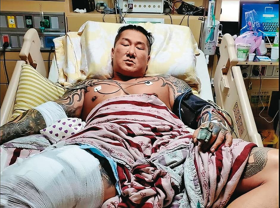 館長在病床上透過直播說槍手朝他頭部開槍,自己是遭買凶狙殺。(翻攝畫面)
