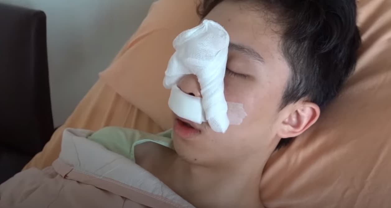 孫安佐日前接受鼻中膈彎曲手術,解決多年來的呼吸問題。(翻攝自YouTube/Sun 孫安佐的頻道 Edward)