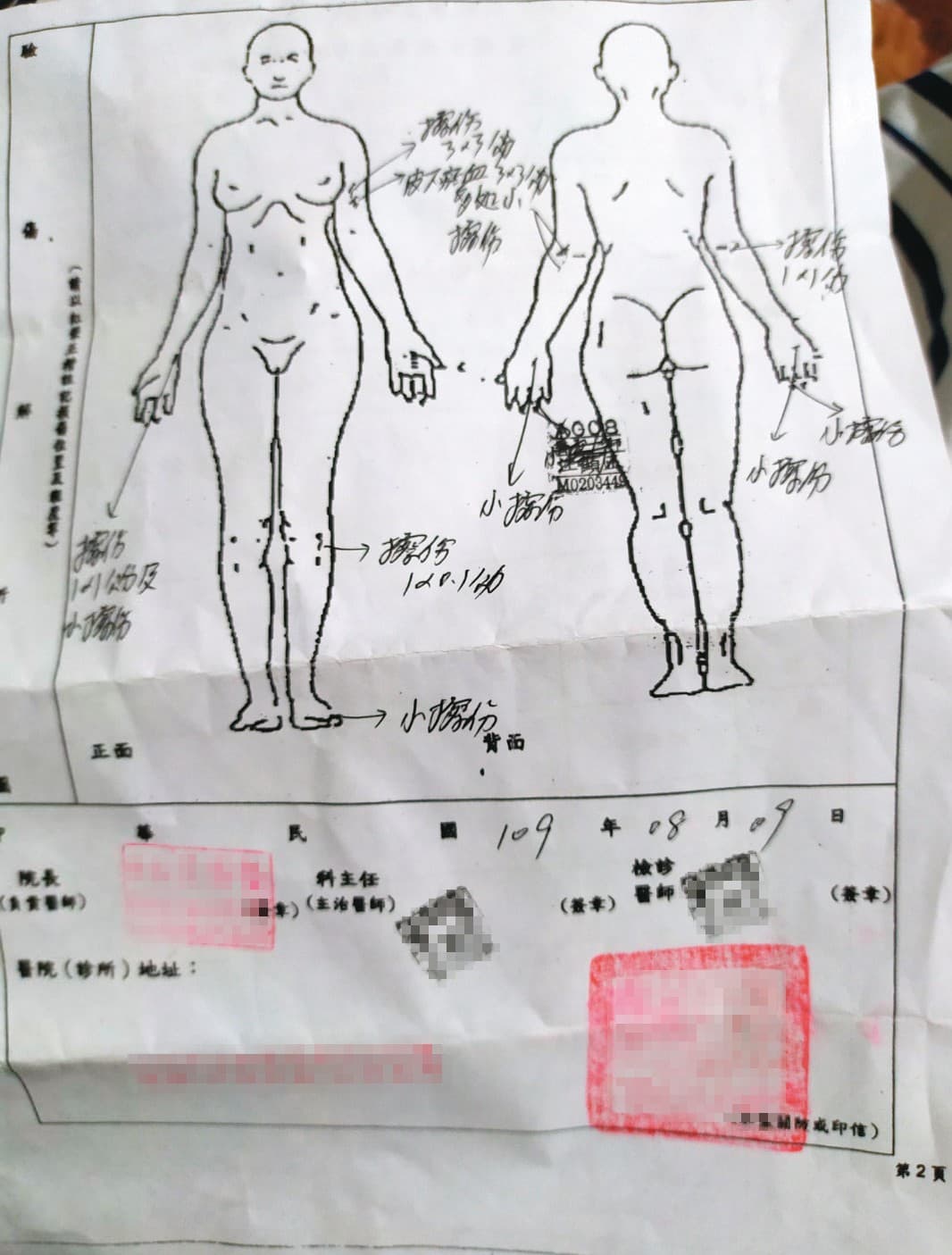 被害人H小姐事後赴醫院驗傷,並對男友提出傷害告訴。(讀者提供)