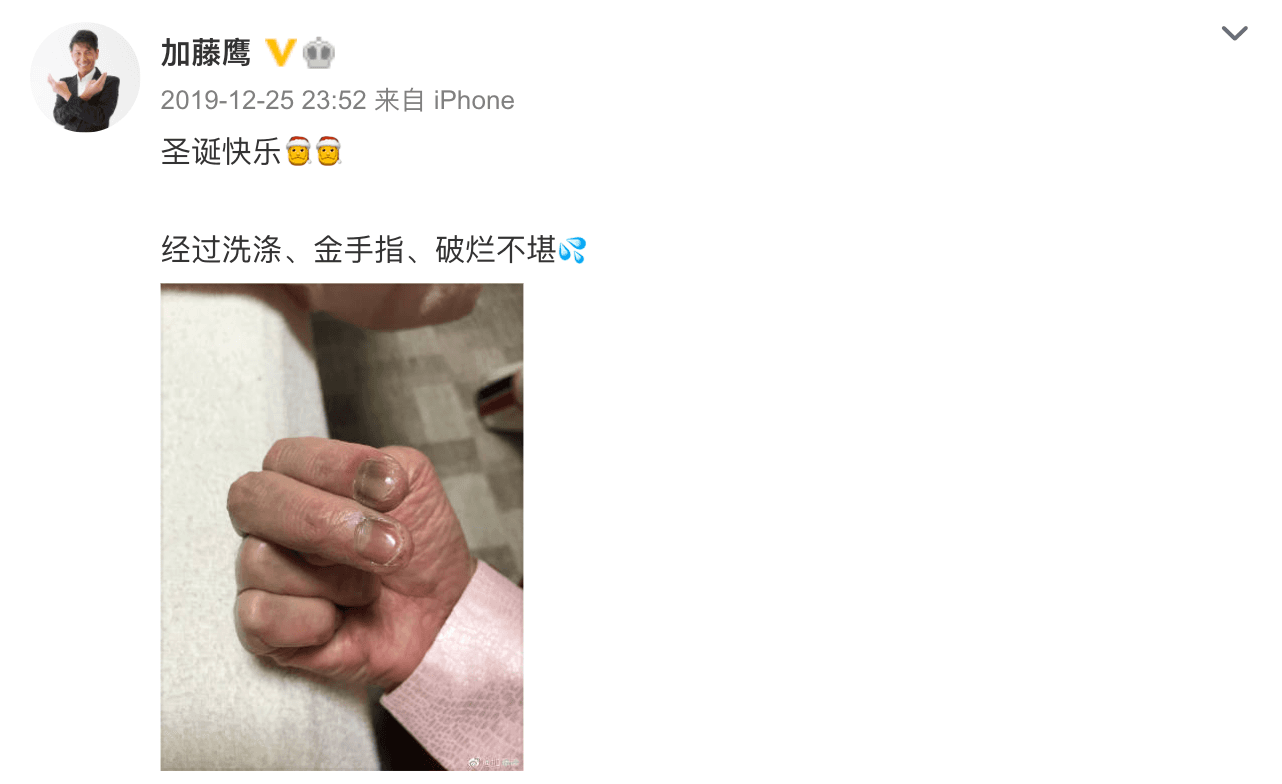 加藤鷹去年聖誕節放上發黑紅腫的金手指照片。(截圖加藤鷹微博)