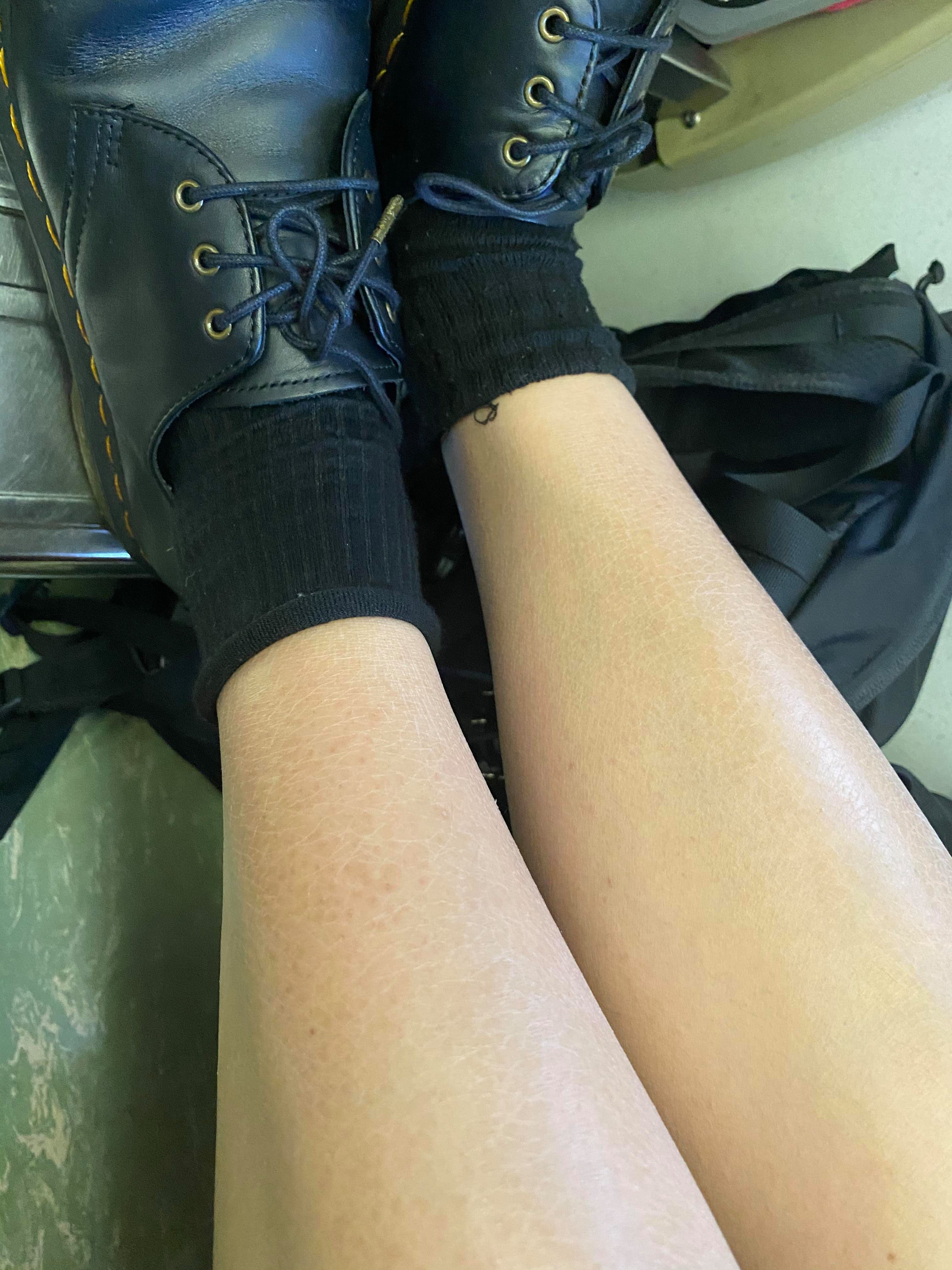 女網友表示,因長期便祕讓皮膚變得非常乾燥,即使前一天剛擦完乳液,隔天皮膚還是很乾。(當事人授權)