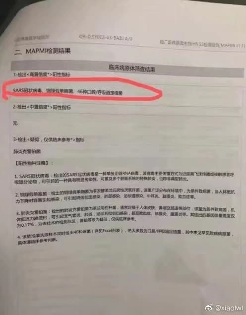 艾芬在一份病毒檢測報告上圈出「SARS冠狀病毒」等字,拍照給同學後被瘋傳,當中也包括李文亮。(翻攝李文亮微博)