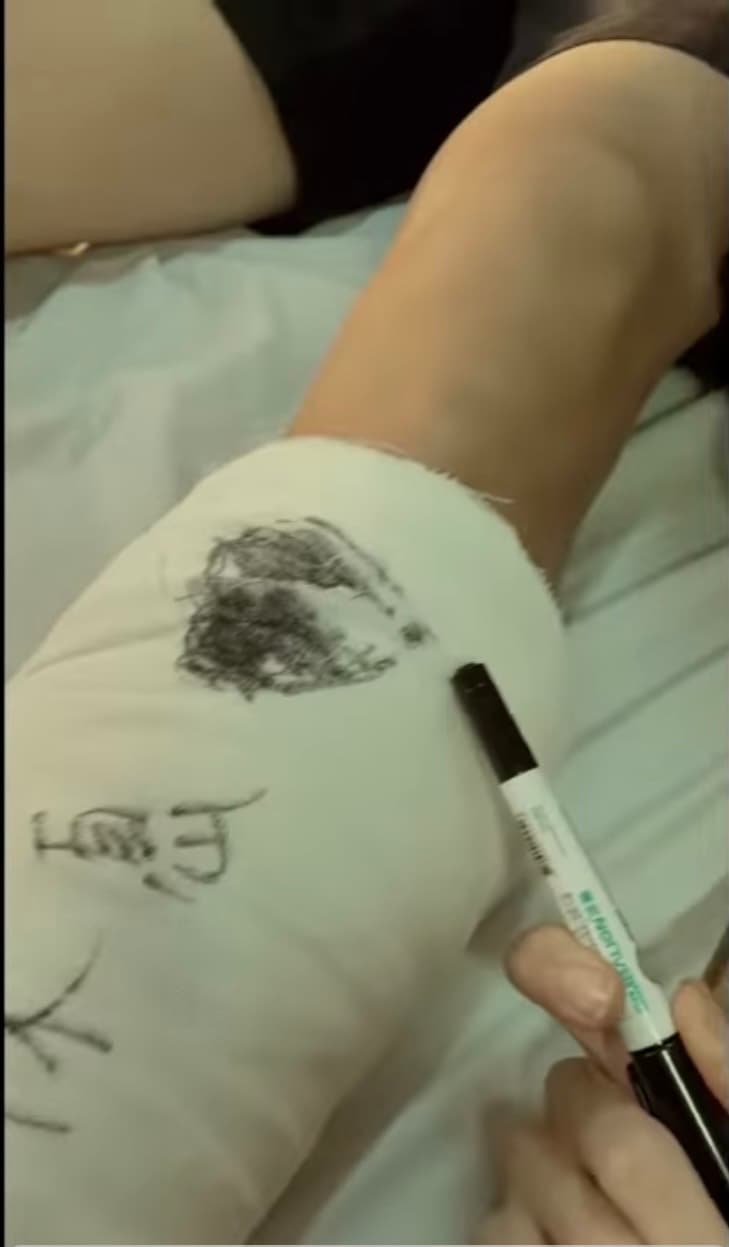 MV中,李宣榕還在胡宇威的左腳骨折石膏上劃上愛心。(翻攝自〈好好〉MV畫面)