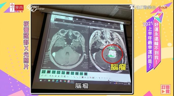 筱蕾在節目上分享發現腦瘤的經過。(翻攝自《女人我最大》YouTube)