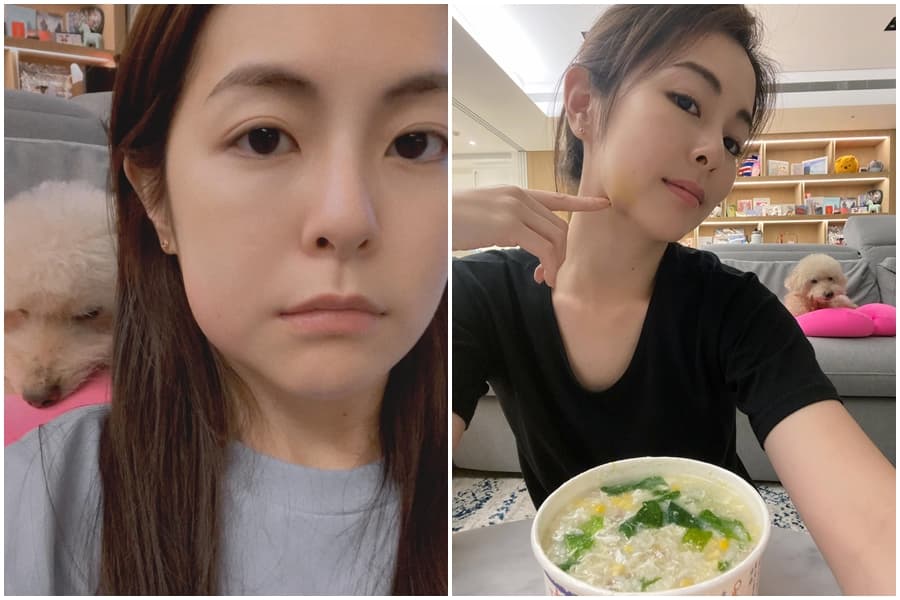 任容萱拔智齒臉腫起來（左圖）；第五天消腫很多，只剩下一點點瘀青（右圖）。（翻攝自任容萱臉書）