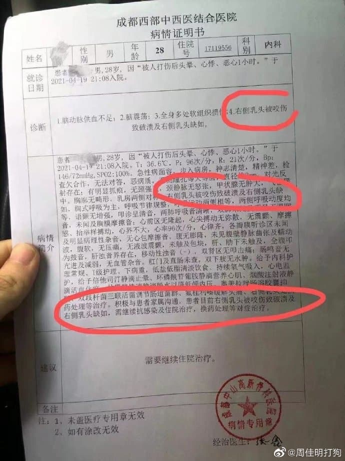 網友貼出健身教練的驗傷單,指魏雷打輸就動嘴咬人。(翻攝自微博)