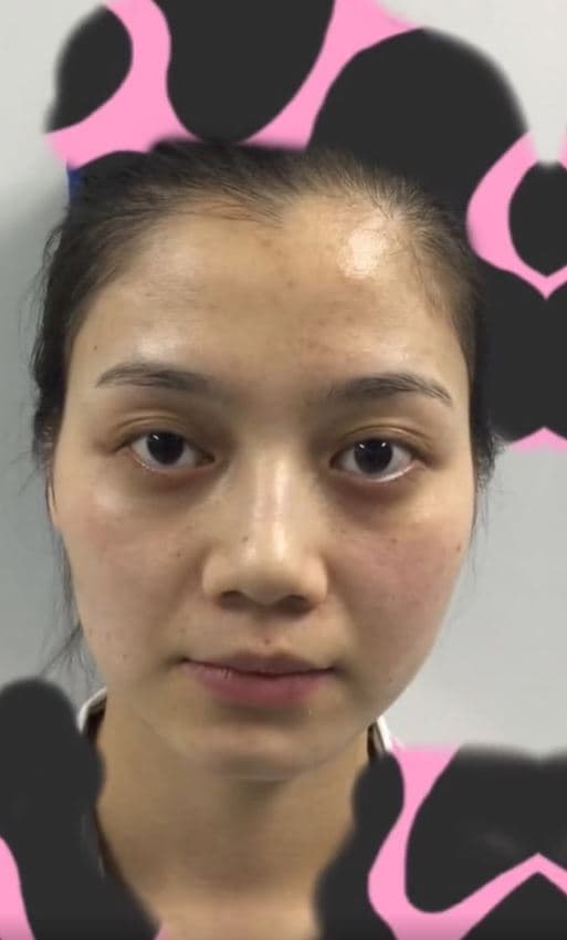 青青日前公開整形前的照片,網友對於前後差異感到震驚。(翻攝自微博)