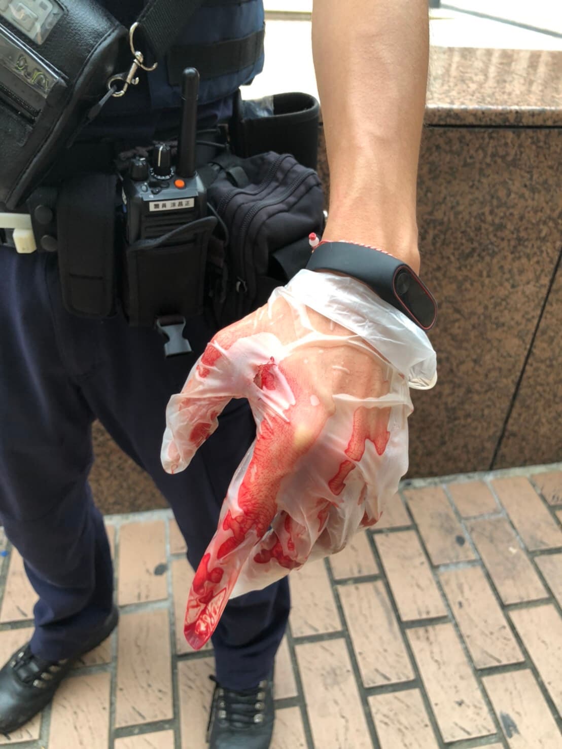 涂姓員警手掌被劃傷。(中正一分局提供)