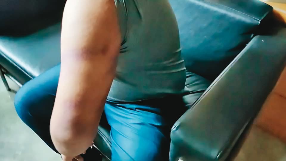 B先生（圖）驗傷後，對蔡姓下士和打人、綽號「龍蝦」的男子提告。