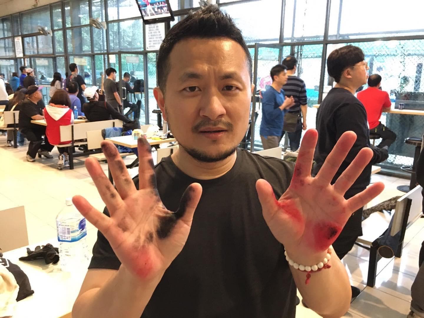 九把刀自願擔任國產疫苗第三階段試驗者。（翻攝自九把刀臉書）