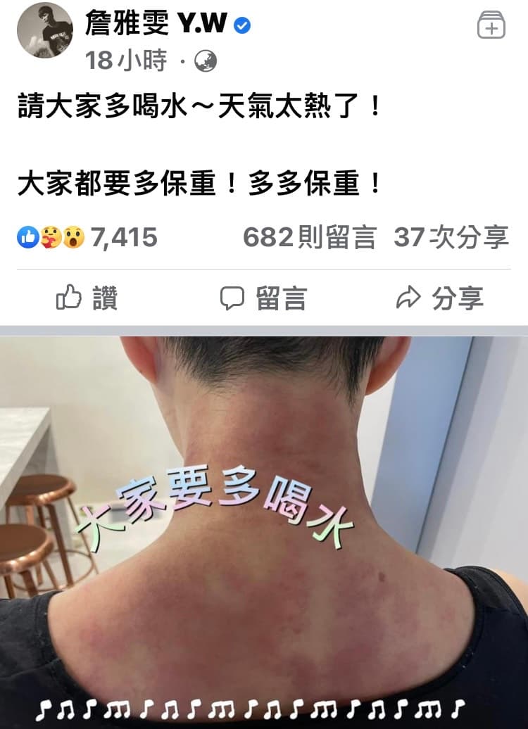 詹雅雯暫停直播多日後，於昨在臉書發文，並上傳多張自己刮痧後滿是血痕的照片。（翻攝自臉書）