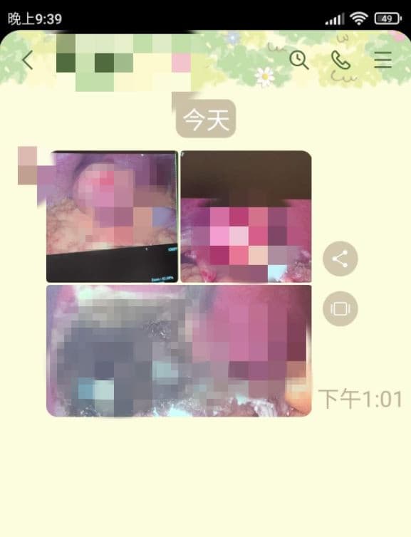 長輩改LINE傳手術照，原PO無奈「還一口氣傳了三張照片，晚餐差點沒吐出來」。（翻攝「爆怨公社」）