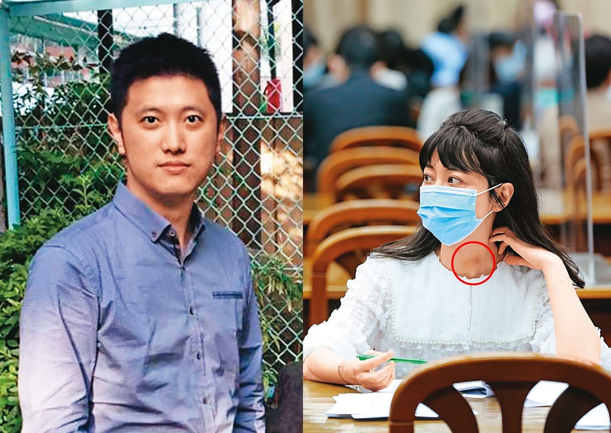 高嘉瑜29日現身立法院財委會等候質詢時,脖子上的瘀傷(紅圈處)還清晰可見。(翻攝自臉書)