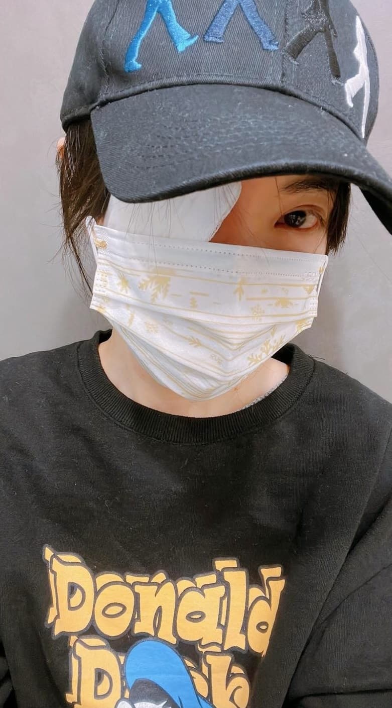 去年12月30日謝金燕曬出慘照,原來是右眼針眼發作。(翻攝謝金燕臉書)