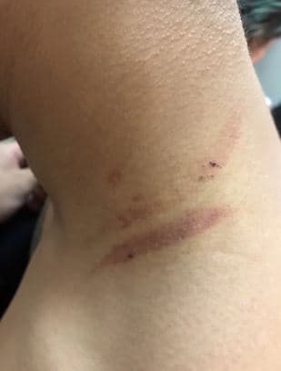陳男被打，身上多處挫傷。（警方提供）