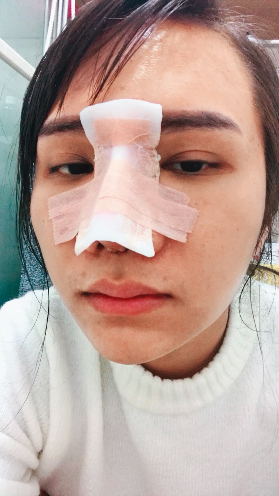 小A辣鼻子動了不少次，她覺得整形自己爽就好，不要在意他人的眼光。（小A辣提供）