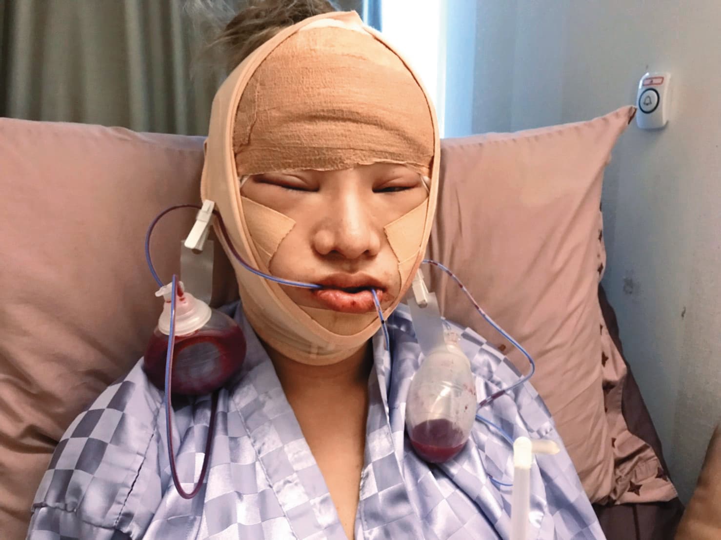 根據本刊估計,小A辣花在全身上下整形的費用已超過300萬元。(小A辣提供)