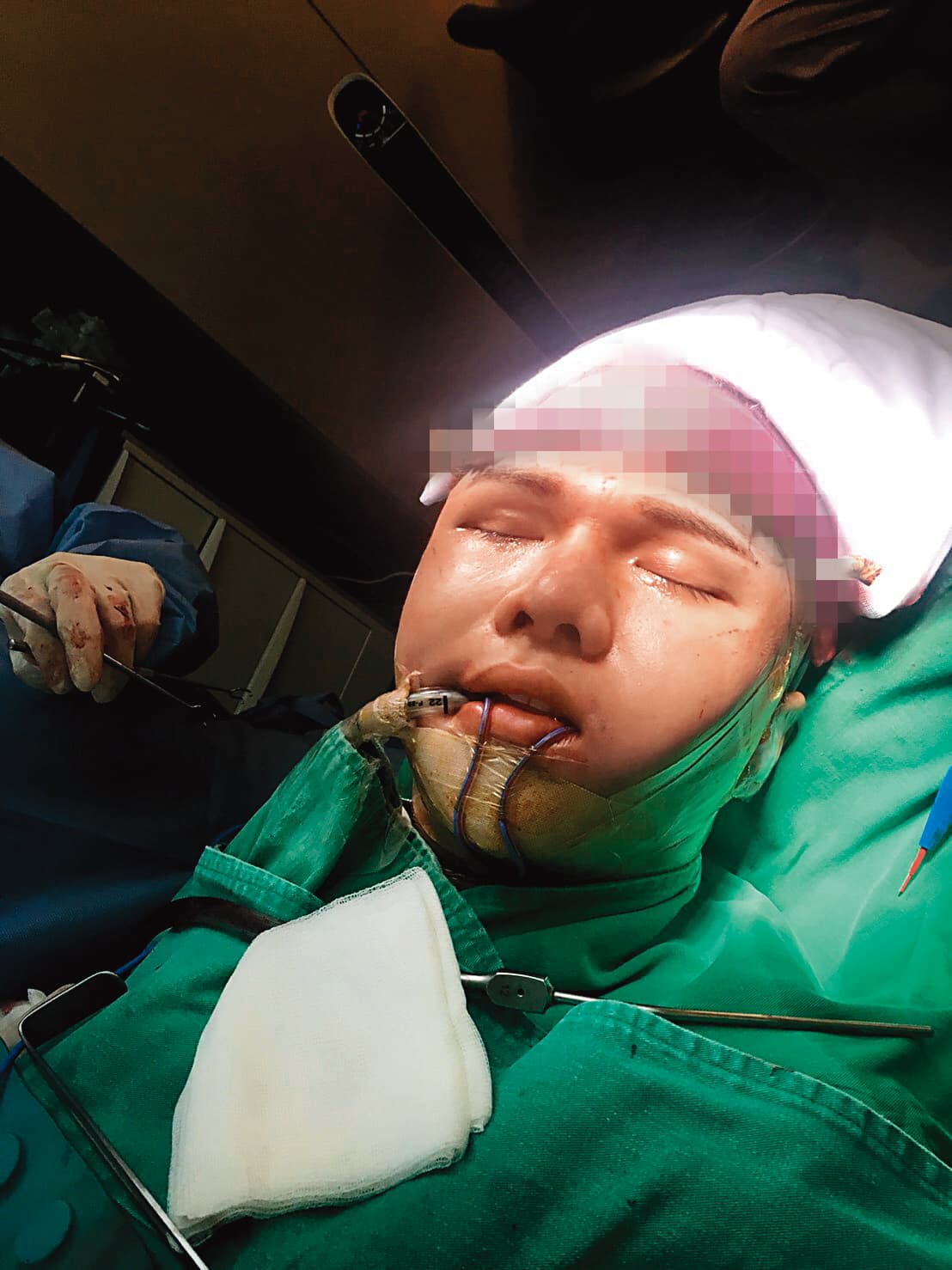 小A辣多半時間都在追求自己的美,而且不惜痛,也不怕分享給大家知道。(小A辣提供)