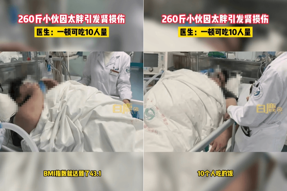 中國有一名男子一天只吃一餐,一餐卻高達10人份,引發肥胖相關疾病。(翻攝自微博)
