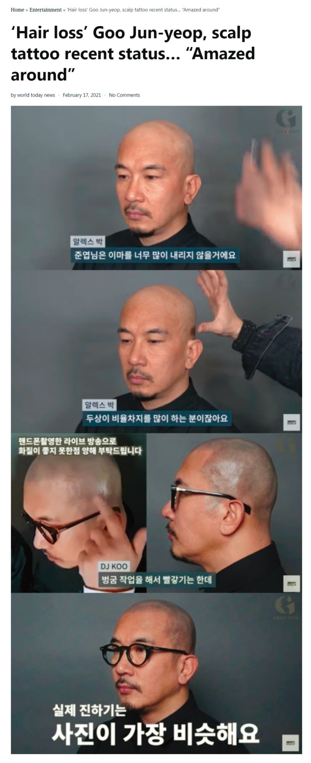 具俊曄曾經拍攝影片,分享自己做頭皮紋身的過程。(翻攝自World Today News)