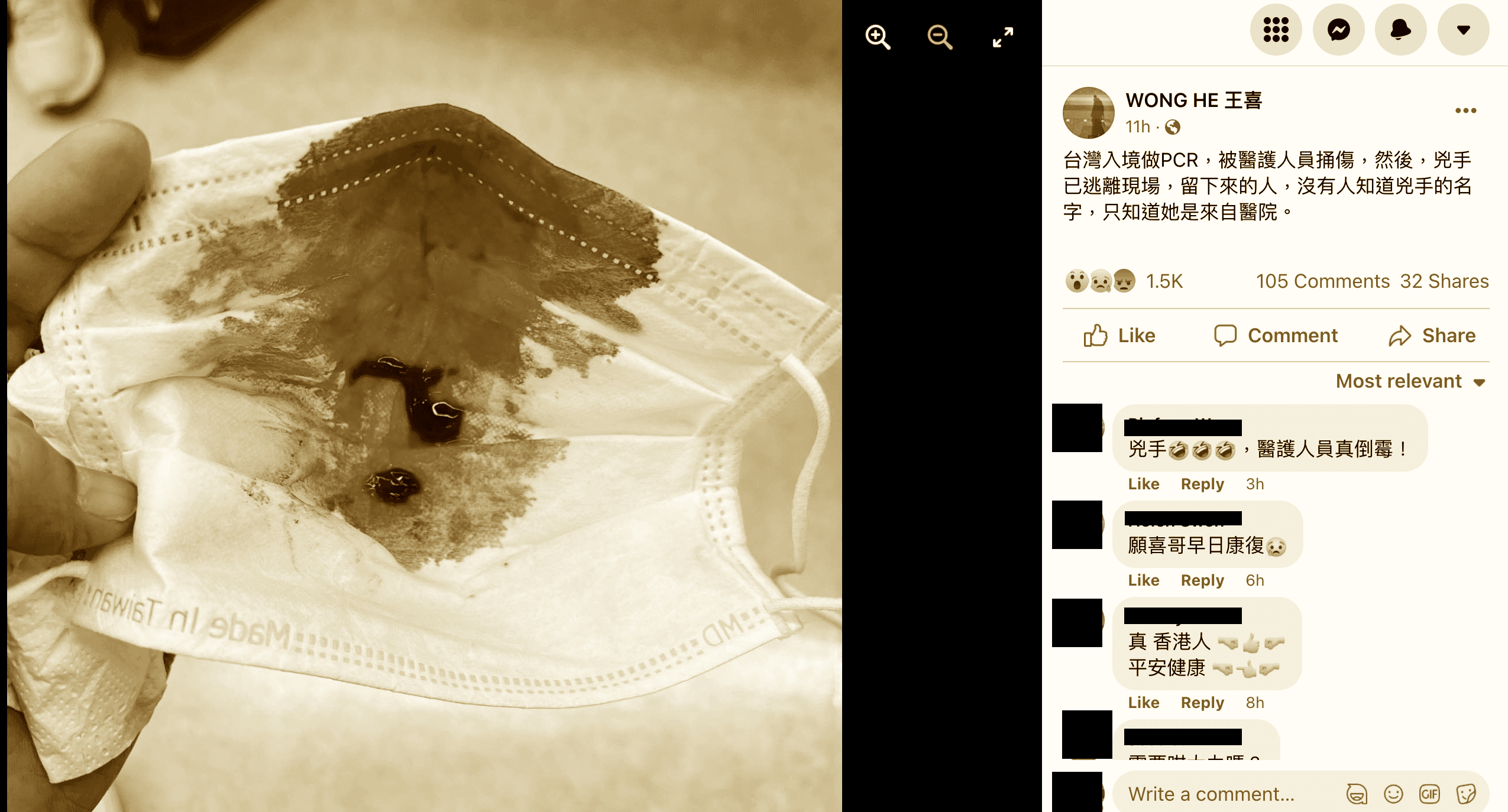 王喜貼出鮮血滿滿的口罩，畫面怵目驚心。（翻攝王喜臉書，畫面經變色處理）
