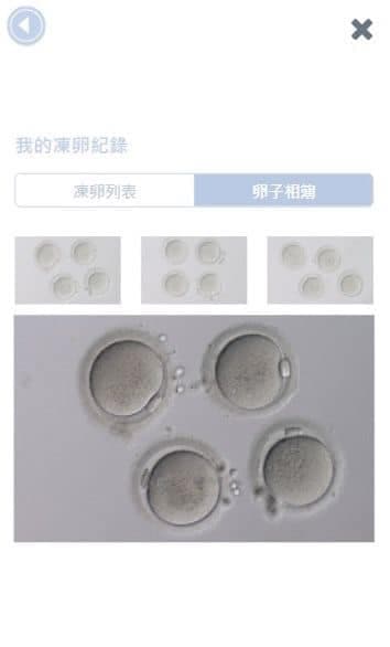 謝盈萱從自己的凍卵APP可以窺見自己的卵子動態。(翻攝謝盈萱臉書)