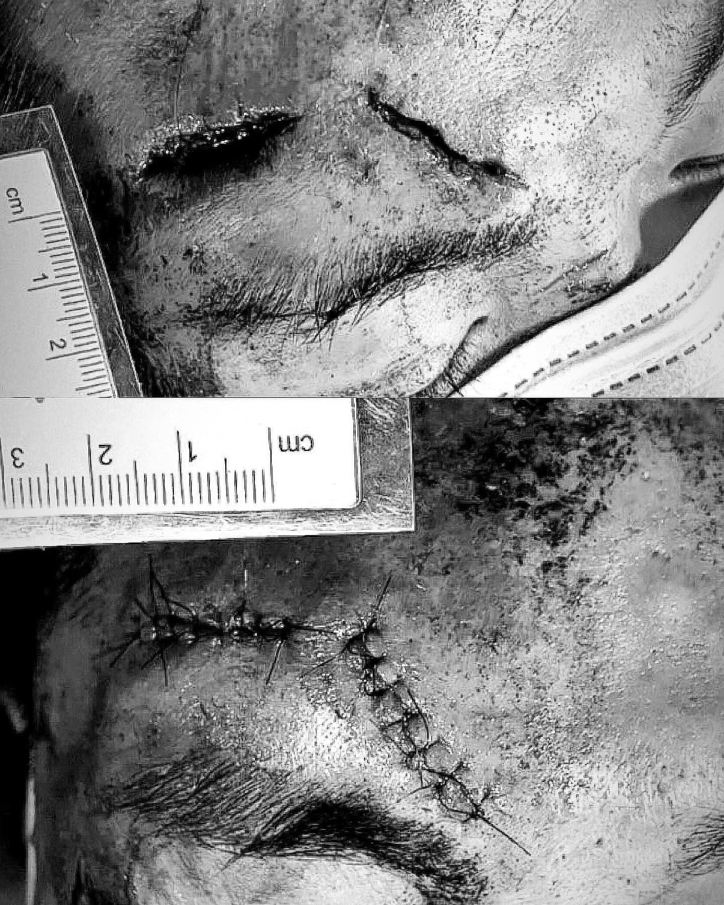 醫師黃京葦貼出警世照，呼籲大家不要玩命，減速慢行、酒後不要騎車、要戴安全帽。（翻攝自嶼上急醫黃京葦臉書）