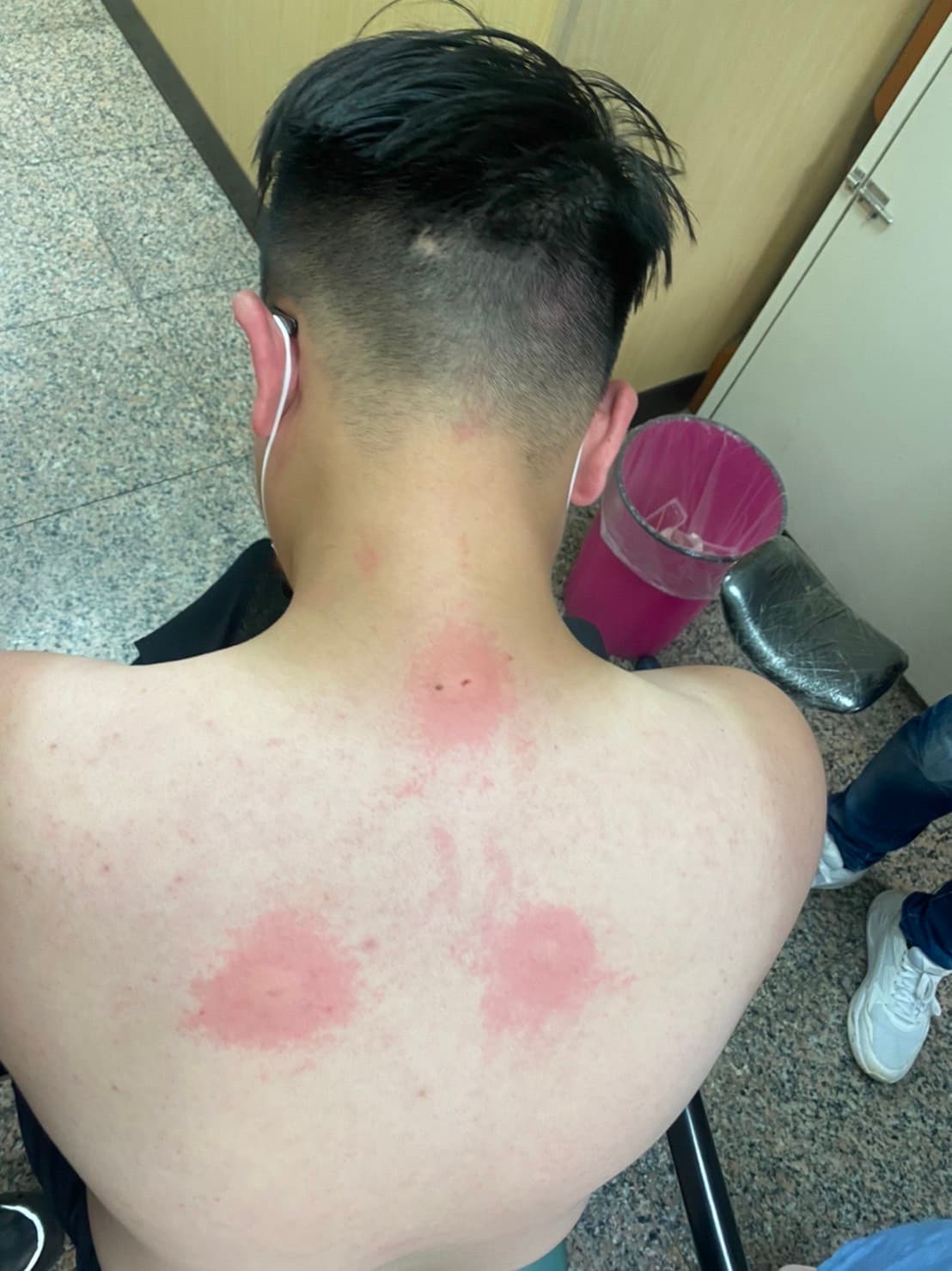 搜山過程,有員警遭虎頭蜂螫傷,幸好沒有生命危險。(警方提供)