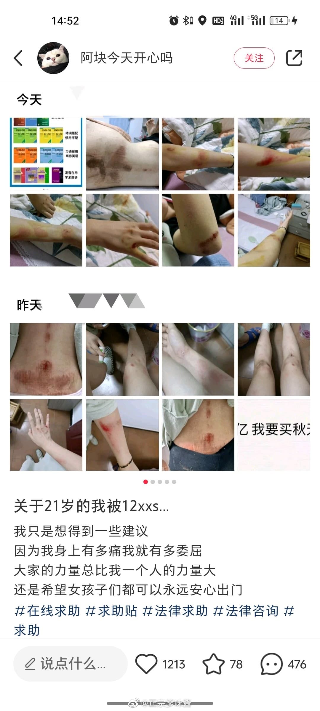 女網友曝光傷勢，怵目驚心。（翻自微博）