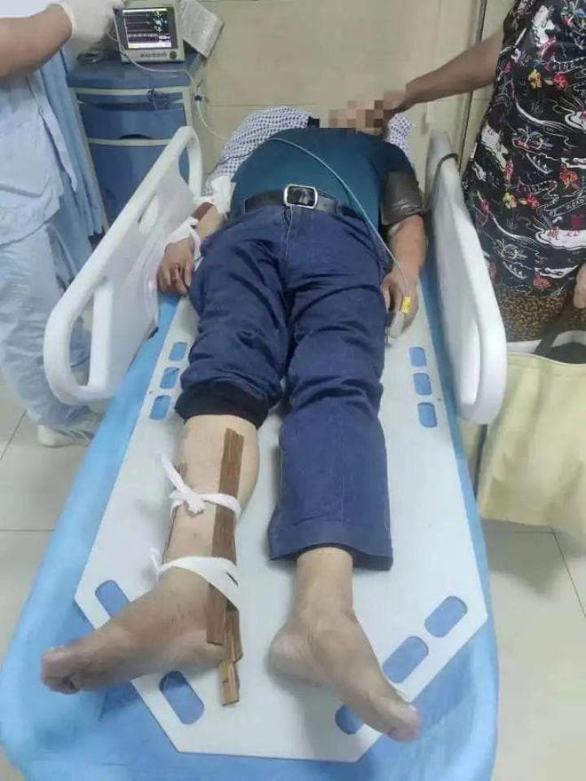老翁手腳骨折。(翻攝自網易新聞)