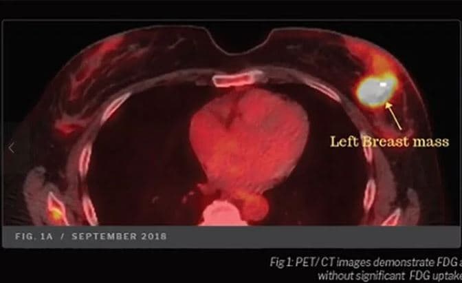 該名婦人已癌末，醫護人員也坦言她的生存率極低。（翻攝《藥物科學、政策和法律》期刊）