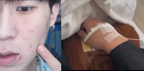 小博動手清理室友發霉床鋪，反而因為太髒而過敏長痘痘，去醫院打點滴。（翻攝抖音）
