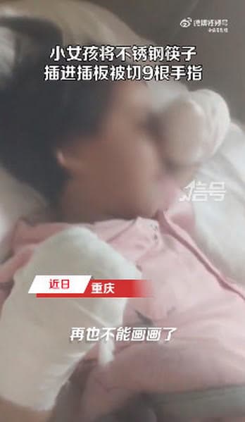 小女孩切除9根手指後,雙手裹上紗布,難過舉手拭淚。(翻攝微博@觀察者網)